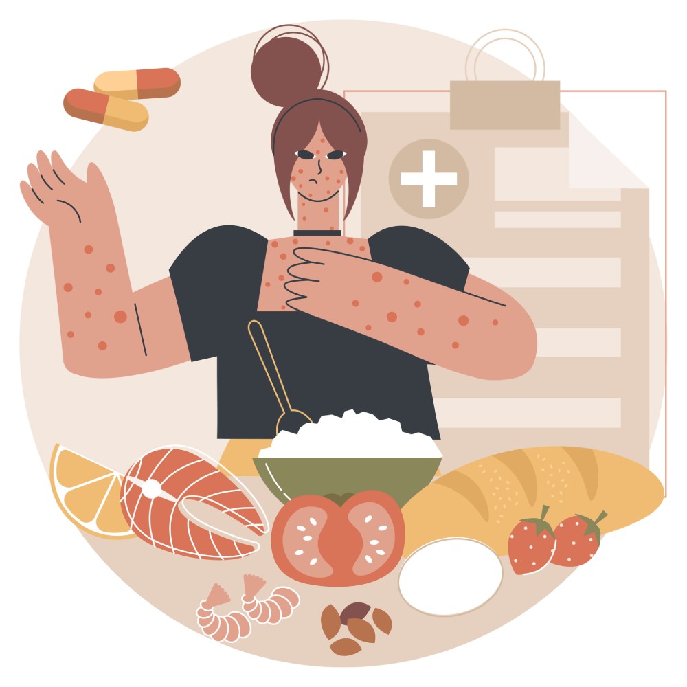 Weight Loss Diet for People with Allergies & Food Intolerances